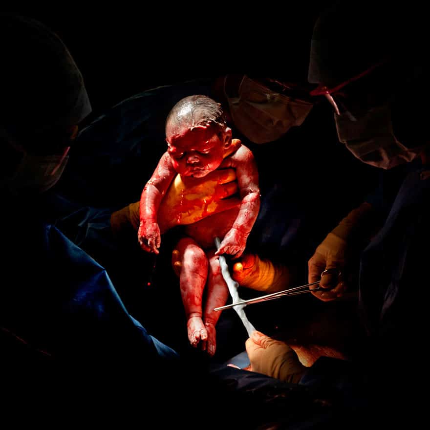 newborn-infant-photos-c-section-cesar-christian-berthelot-1