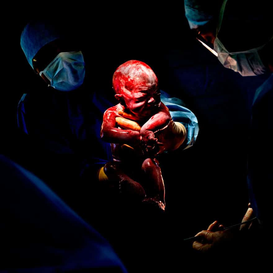 newborn-infant-photos-c-section-cesar-christian-berthelot-10