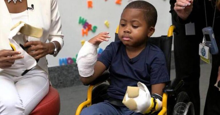 Η πρώτη στον κόσμο μεταμόσχευση και των δύο χεριών σε παιδί!