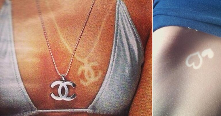 15 άτομα που κάηκαν από τον ήλιο επίτηδες για να “κάνουν” τατουάζ!