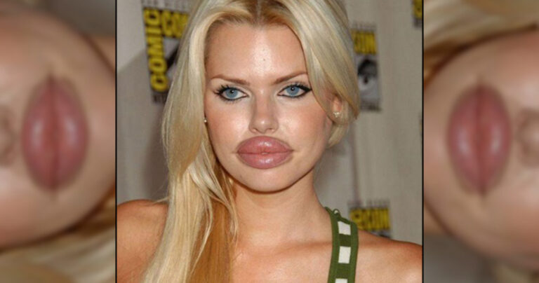 27 πλαστικές επεμβάσεις που δεν είχαν καλό αποτέλεσμα