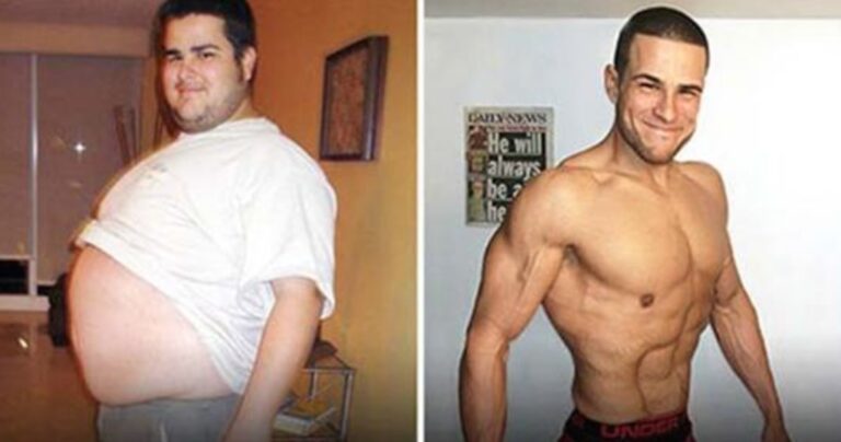 33 φοβερές περιπτώσεις από μεταμορφώσεις σωμάτων