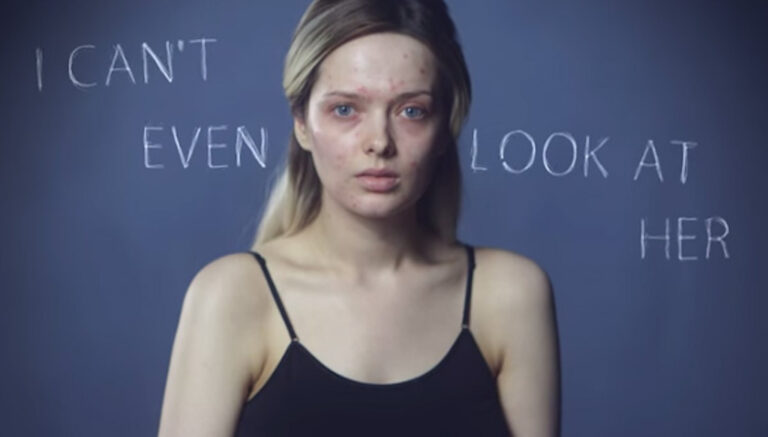 Ξεκίνησε να ανεβάζει φωτογραφίες του εαυτού της χωρίς μακιγιάζ. Τα σχόλια που δέχτηκε σοκάρουν!