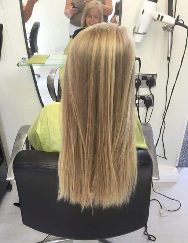 girl-cancer-hair-2