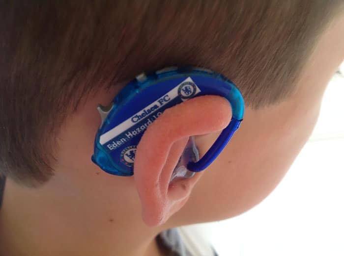 hearing-aid-decorations-kids-cochlear-implant-sarah-ivermee-lugs-1
