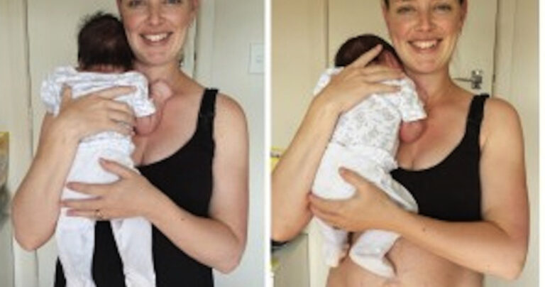 Μητέρα φωτογραφίζει και δημοσιεύει την κοιλιά της μετά τη γέννηση του παιδιού της!