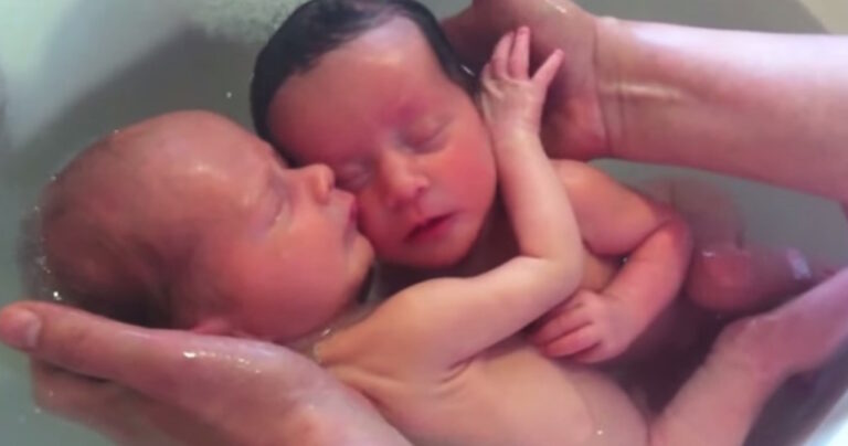 Αυτά τα δίδυμα δεν έχουν καταλάβει ότι έχουν γεννηθεί