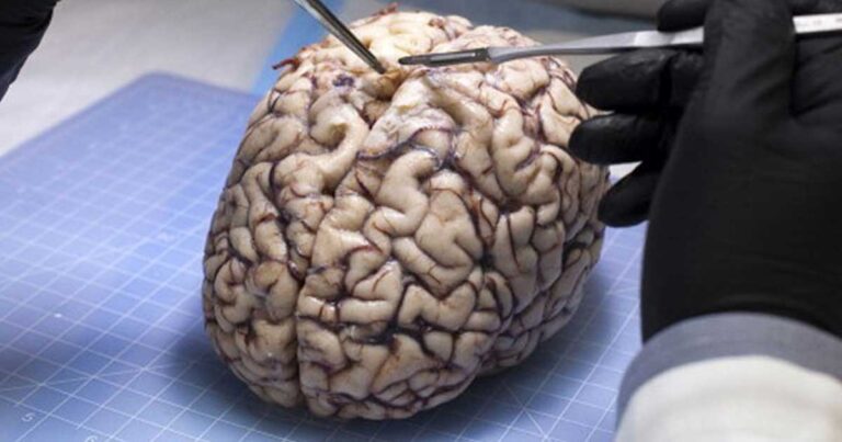 24 πληροφορίες για τον ανθρώπινο εγκέφαλο που θα… σκαλώσουν το μυαλό σας!