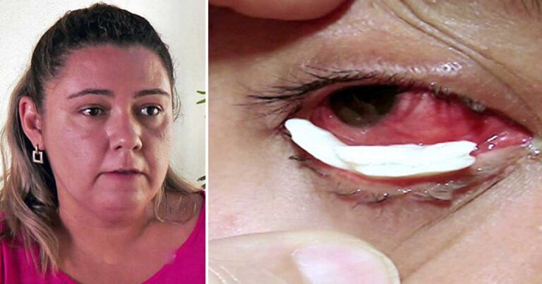 Η γυναίκα με μια μυστήρια πάθηση: Kάθε φορά που κλαίει βγαίνουν από τα μάτια της κρύσταλλοι.