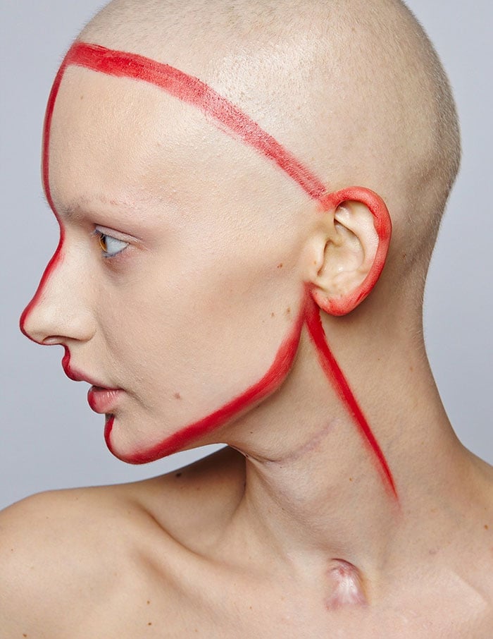 jaw-cancer-model-19