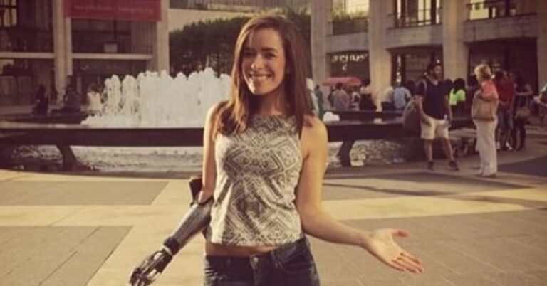 Της είπαν επειδή έχει ένα χέρι δεν θα γίνει πότε μοντέλο. Έκαναν όμως λάθος…