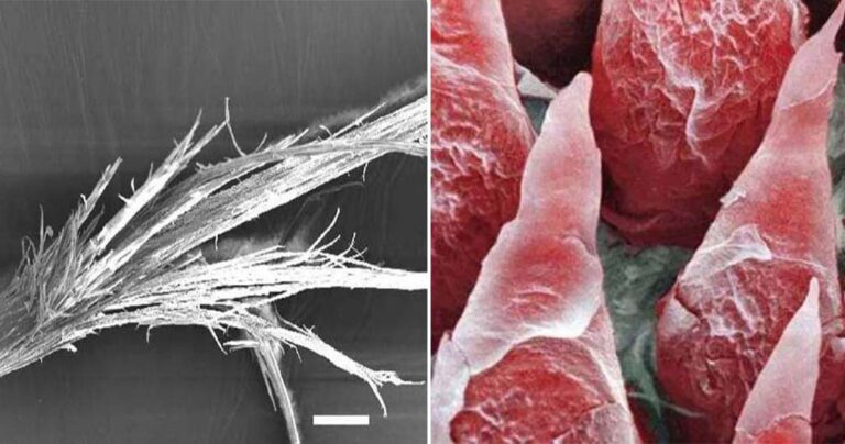 18 φωτογραφίες του ανθρώπινου σώματος από μικροσκόπιο