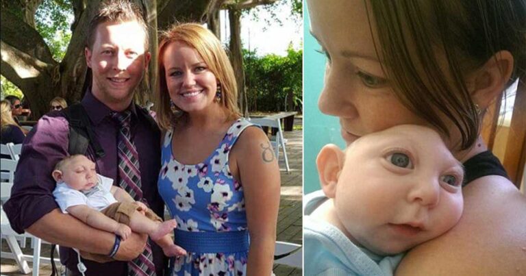 Το μωρό που γεννήθηκε χωρίς κρανίο έγινε ενός έτους!