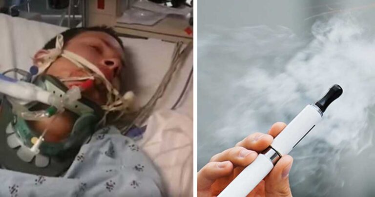 Παραλίγο να χάσει την ζωή από το ηλεκτρονικό τσιγάρο που έσκασε στο πρόσωπο του.
