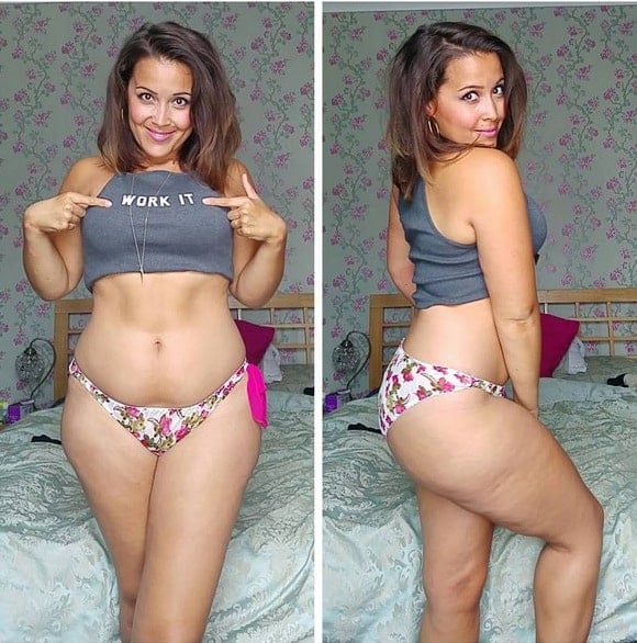 anorexia anarrwsi2