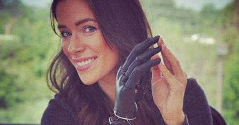 Rebekah Marine: Η όμορφη 28χρονη που είναι γνωστή ως το «βιονικό μοντέλο»