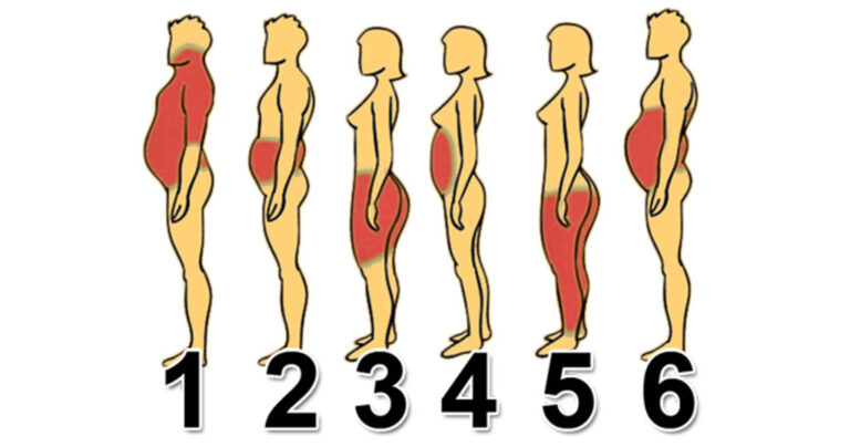 Πώς να πολεμήσετε το πάχος αναλόγα με το σημείο που βρίσκεται