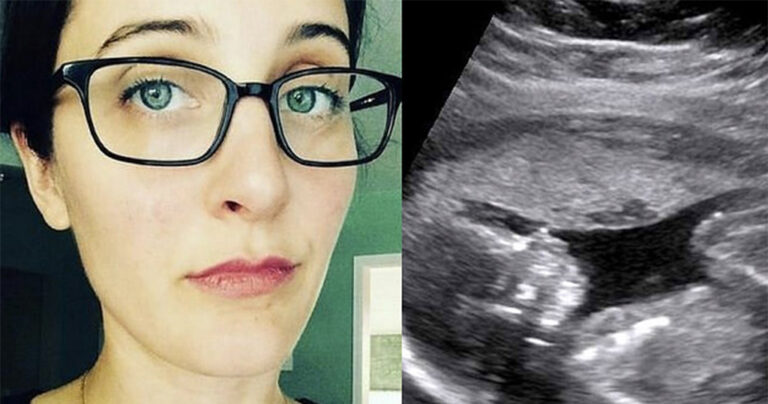 Την ρωτούσαν συνέχεια “πότε θα κάνει παιδιά”. Τους έδωσε μια φοβερή απάντηση!