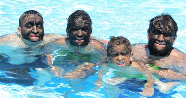 H oικογένεια «λυκανθρώπων» που φοβάται να κυκλοφορήσει στο δρόμο γιατί ο κόσμος τους επιτίθεται και τους βρίζει.