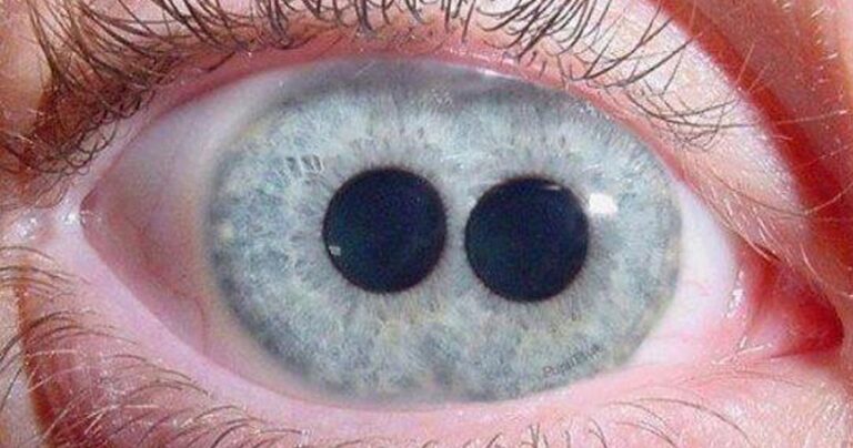 Οι 10 πιο περίεργες ιατρικές παθήσεις που υπάρχουν.