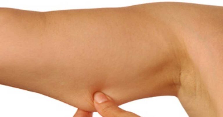 Συμβουλές για την αντιμετώπιση των πλαδαρών μπράτσων