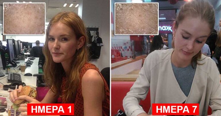 Έτρωγε μια εβδομάδα μόνο junk food και δείτε τι έγινε…