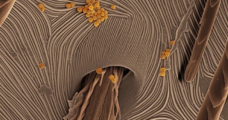 35 εικόνες από καθημερινά πράγματα κάτω από το μικροσκόπιο που θα σας αφήσουν με το στόμα ανοιχτό