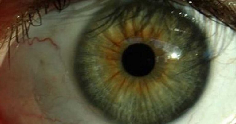 Αυτά είναι τα πιο σπάνια χρώματα ματιών στον κόσμο