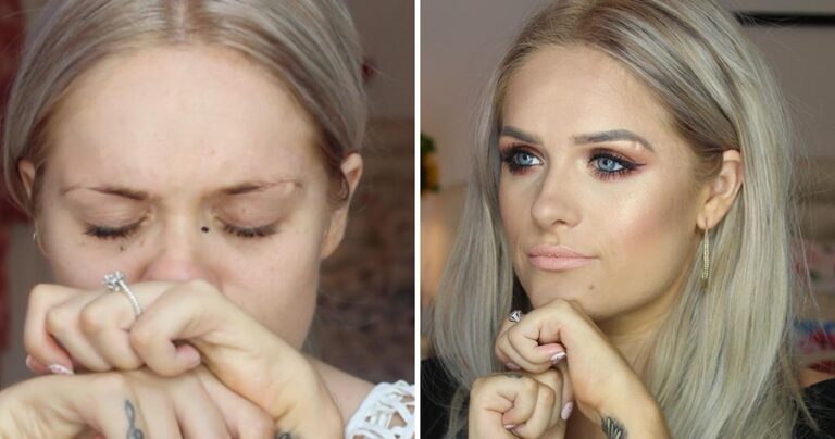 H μπλόγκερ ομορφίας που συγκίνησε εκατομμύρια κόσμο με την αποκάλυψη του μυστικού της