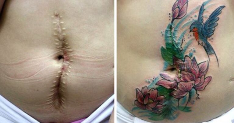 Δωρεάν τατουάζ σε αυτούς που έχουν σημάδια ενδοοικογενειακής βίας!