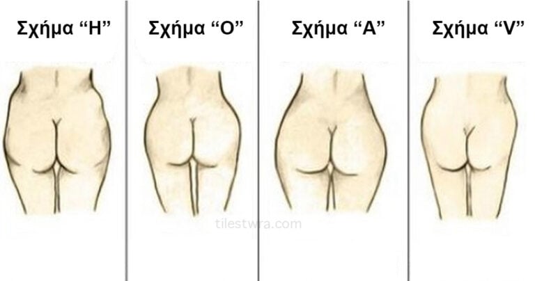 Τι αποκαλύπτει το σχήμα των οπισθίων για την υγεία σας;