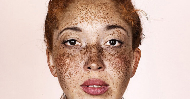 Φωτογραφίζοντας ανθρώπους με φακίδες από όλο τον κόσμο