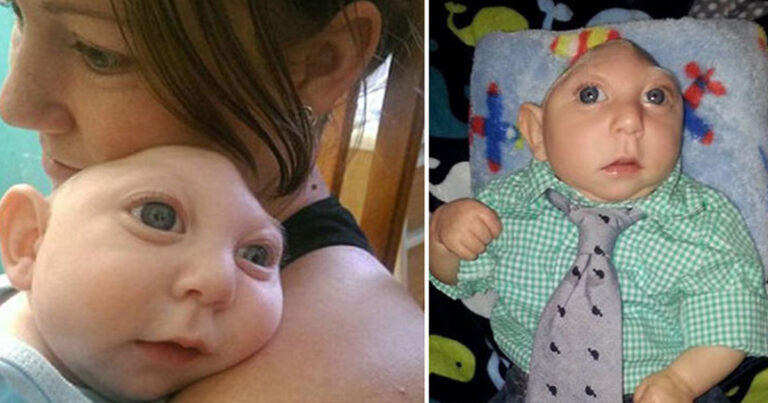 Το μωρό με το μισό κεφάλι λέει για πρώτη φορά σε βίντεο στη μαμά του ότι την αγαπάει.