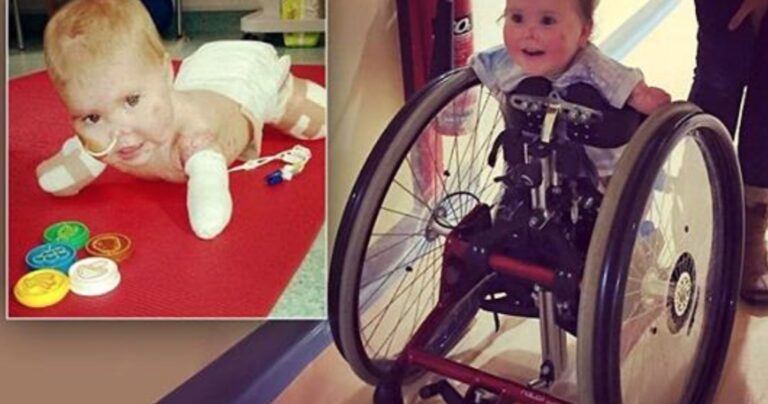 Η Γενναία κουκλίτσα που έχασε όλα της τα άκρα από μηνιγγίτιδα μπορεί ξανά και μετακινείται!