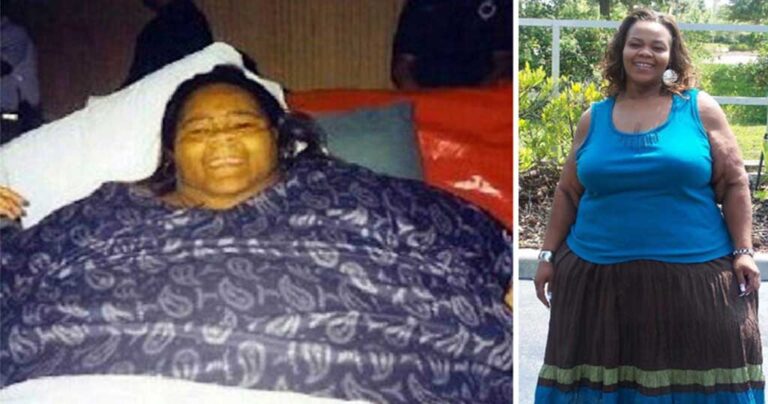 Η παχύτερη γυναίκα στον κόσμο που έχασε 230 κιλά!