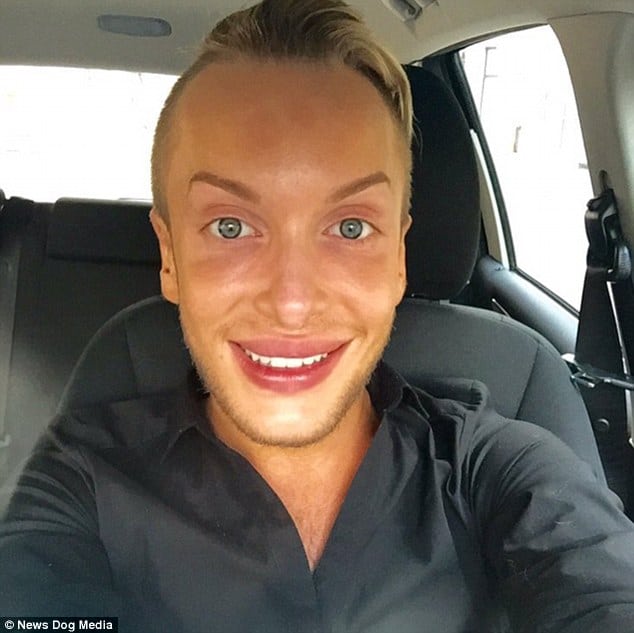 2D95E1D800000578-3280593-Quentin_shows_the_results_of_his_lip_fillers_and_Botox_in_a_self-a-24_1445345273032