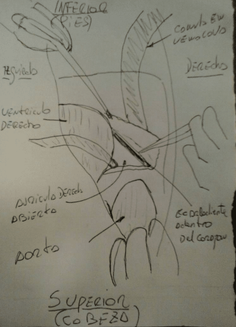 mans-stabbing-pain-caused-by-toothpick-accidentally-swallowed4