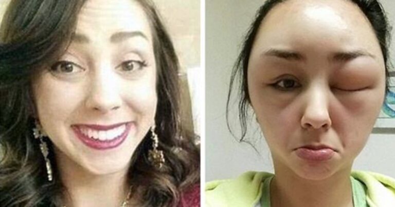 Έβαψε τα μαλλιά της και παραμορφώθηκε όλο της το πρόσωπο.