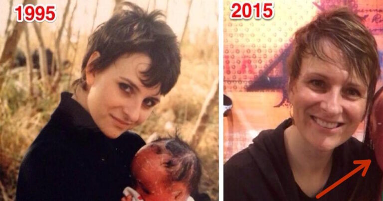 Έκρυψαν αυτό το μωρό για να μην δει κανείς αυτό το πρόσωπο. Δείτε την γυναίκα 22 χρόνια μετά