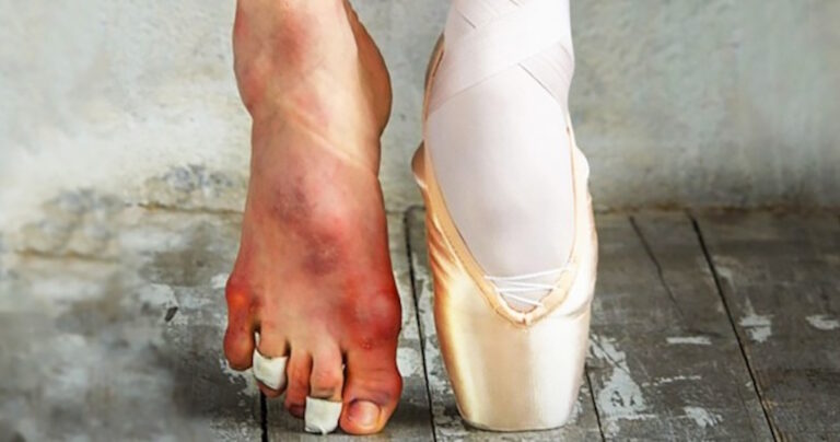 «Το κόστος του χειροκροτήματος»: Μια δυνατή εικόνα με ένα σημαντικό μήνυμα