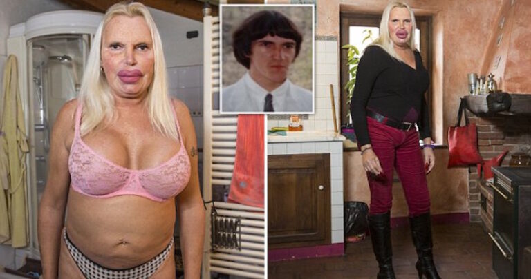 Διεμφυλική εθισμένη στις επεμβάσεις ξοδεύει 52.000 δολάρια για να πετύχει το τέλειο σώμα.