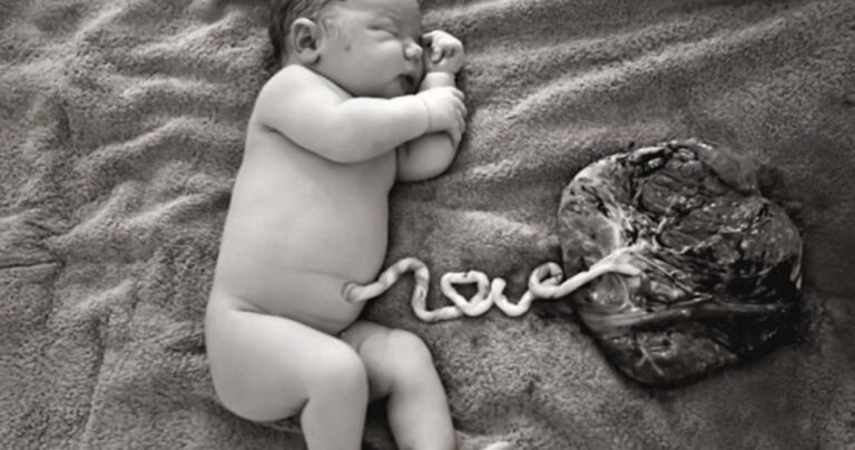 Η φωτογραφία με τον πλακούντα του μωρού που προκάλεσε σάλο στο διαδίκτυο. Είναι τελικά τόσο ταμπού ένας πλακούντας;