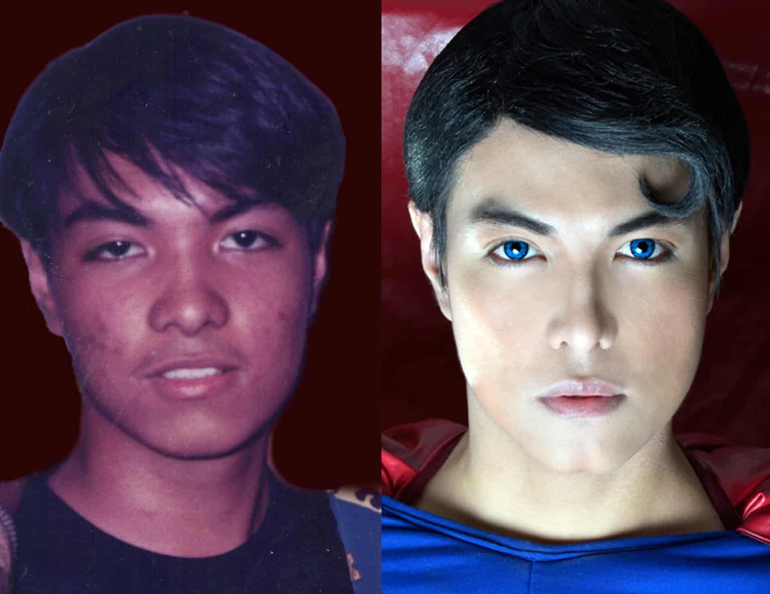 Superman Fan Undergoes Plastic Surgery To Look Like His Favorite Superhero