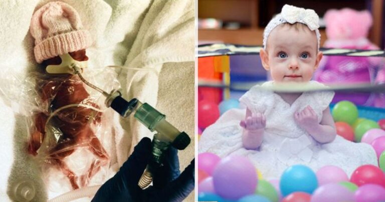 Η μικροσκοπική αγωνίστρια που γεννήθηκε μισό κιλό και χθες έσβησε το πρώτο της κεράκι.