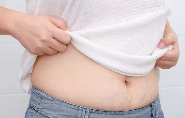 woman showing her stretch marks