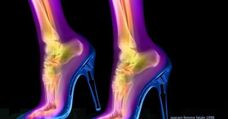 Αυτές οι πραγματικές ακτινογραφίες θα αλλάξουν τον τρόπο που βλέπετε το σώμα σας.