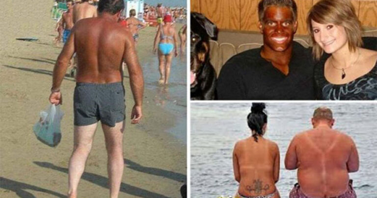 16 περιπτώσεις που το μαύρισμα έχει κωμικοτραγικά αποτελέσματα