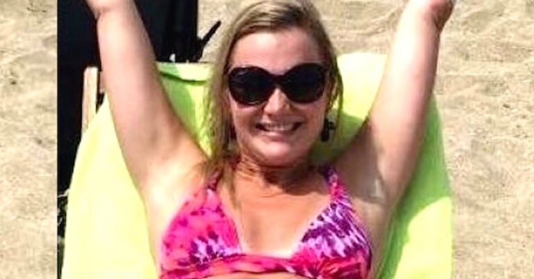 Μια κοπέλα με ακρωτηριασμένα άκρα μοιράζετε μια εμπνευσμένη φωτογραφία με μαγιό.