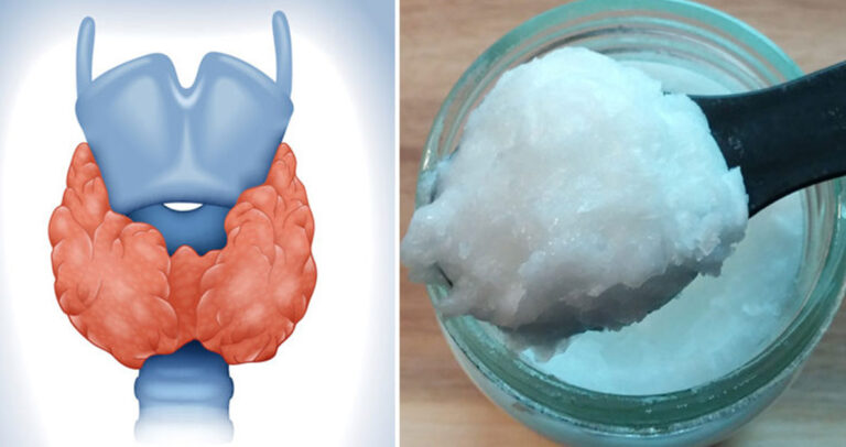 Φάτε μια κουταλιά λάδι καρύδας την ημέρα και αυτό θα γίνει με τον θυρεοειδή σας.