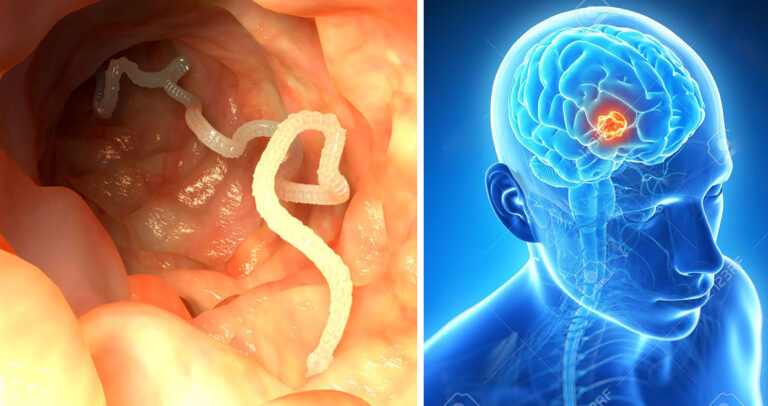 Τρώγοντας αυτή την πολύ συνηθισμένη τροφή μπορεί να κάνετε σκουλήκια στον εγκέφαλο.